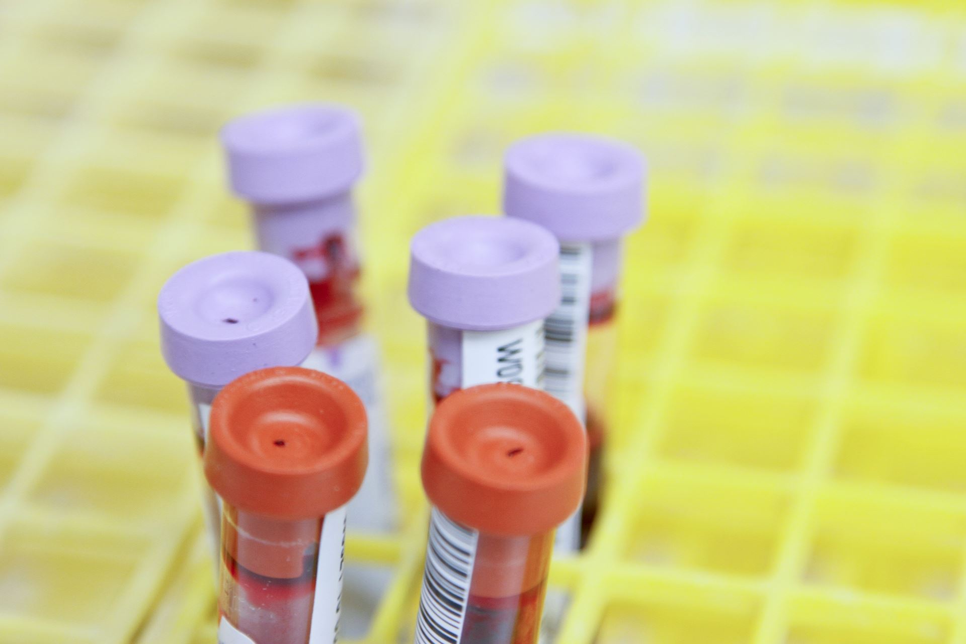 test tubes